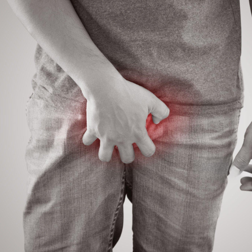 Pembengkakan pada Area Genital