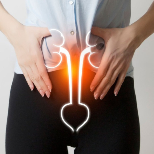 Penyakit Radang Panggul (PID)