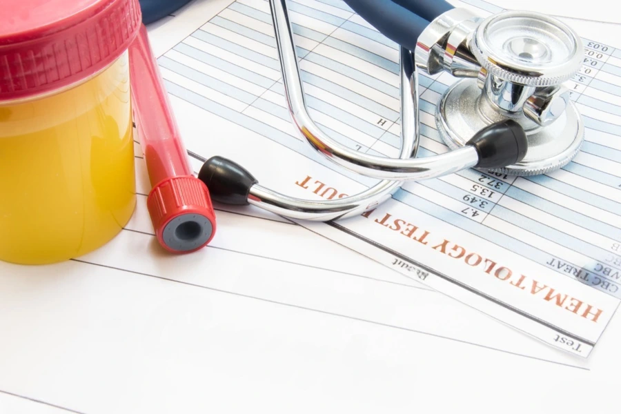 Mengapa Gonore Kambuh Lagi? Yuk, Cari Tahu Penyebabnya! 